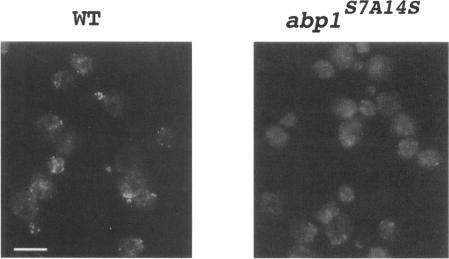 https://cdn.ncbi.nlm.nih.gov/pmc/blobs/37ab/276086/b106a9668832/mbc00002-0186-a.jpg
