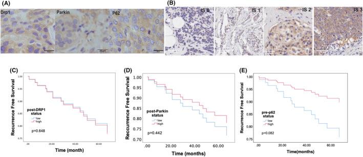 https://cdn.ncbi.nlm.nih.gov/pmc/blobs/37c0/10854452/53c5e9ee1fea/CAM4-13-e6987-g001.jpg