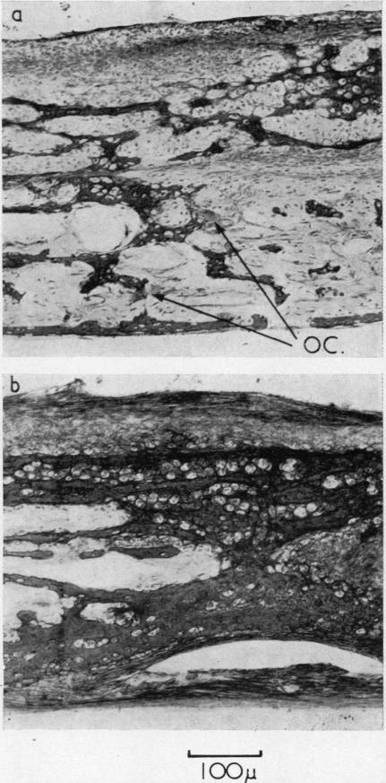 https://cdn.ncbi.nlm.nih.gov/pmc/blobs/37c1/1031170/72831c454716/annrheumd00236-0008-a.jpg