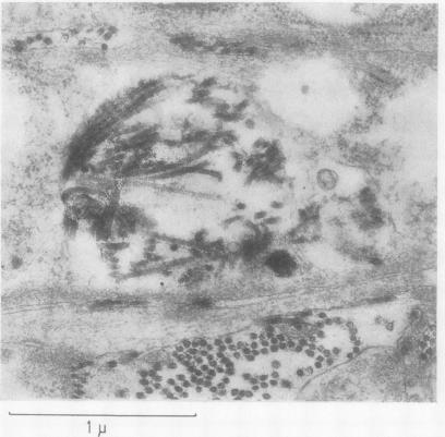 https://cdn.ncbi.nlm.nih.gov/pmc/blobs/37c1/1031170/818cc195bf36/annrheumd00236-0013-a.jpg