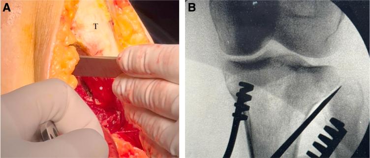 https://cdn.ncbi.nlm.nih.gov/pmc/blobs/37c1/11977168/edae347a32fd/gr5.jpg