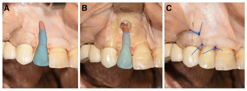 https://cdn.ncbi.nlm.nih.gov/pmc/blobs/37c5/10572956/288c78f44752/diagnostics-13-03037-g007.jpg