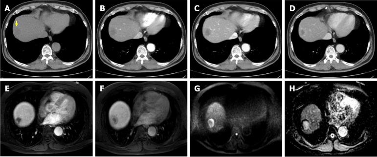 https://cdn.ncbi.nlm.nih.gov/pmc/blobs/37c6/12188779/6941fb39526a/wjcc-13-22-104924-g001.jpg