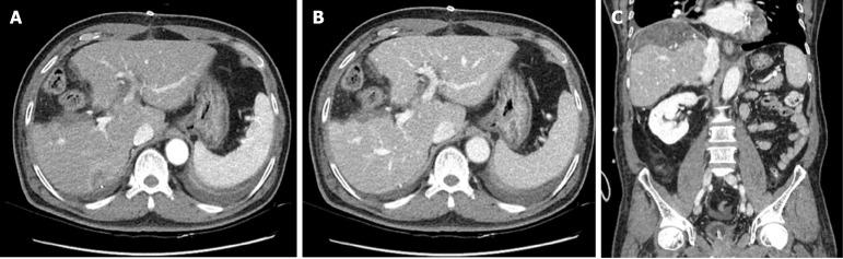 https://cdn.ncbi.nlm.nih.gov/pmc/blobs/37c6/12188779/7096187f69ee/wjcc-13-22-104924-g004.jpg