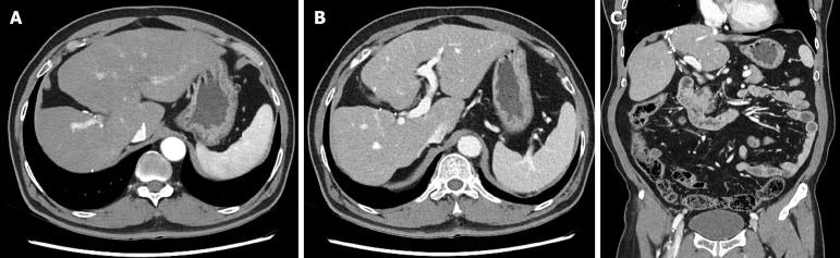 https://cdn.ncbi.nlm.nih.gov/pmc/blobs/37c6/12188779/da18f1faf5ab/wjcc-13-22-104924-g005.jpg