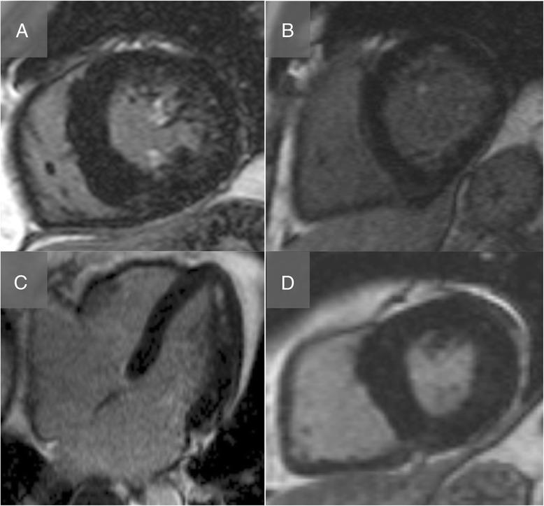 https://cdn.ncbi.nlm.nih.gov/pmc/blobs/37c8/4534050/42b1c313d962/12968_2015_176_Fig3_HTML.jpg