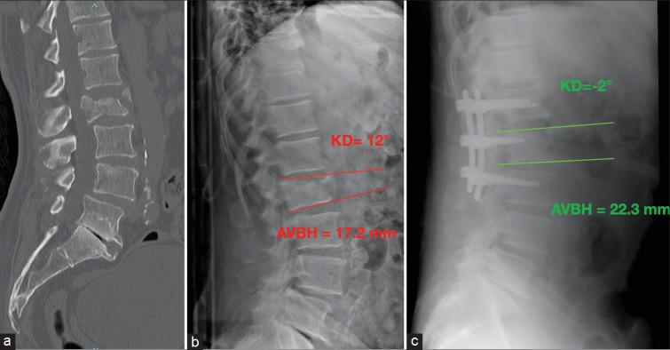 https://cdn.ncbi.nlm.nih.gov/pmc/blobs/37ce/10927060/fb4c55f5351e/JNRP-15-034-g003.jpg
