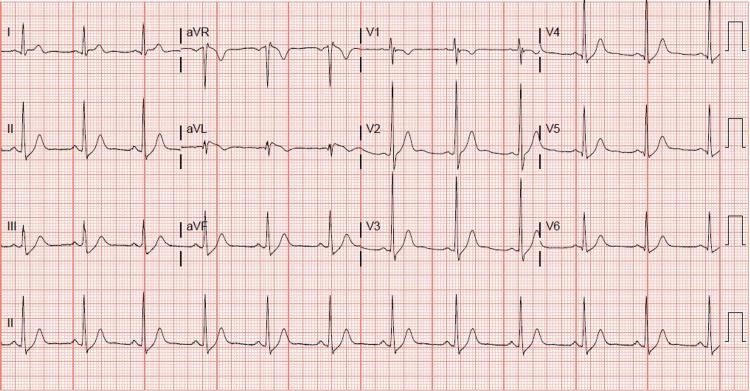 https://cdn.ncbi.nlm.nih.gov/pmc/blobs/37d2/8608670/5ffb4117547b/cureus-0013-00000019058-i03.jpg