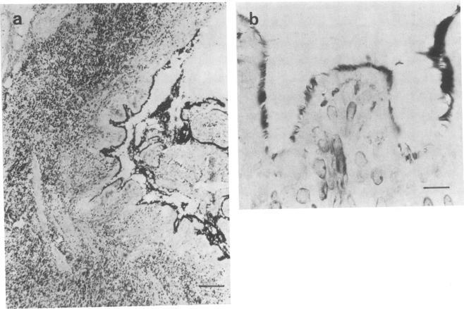 https://cdn.ncbi.nlm.nih.gov/pmc/blobs/37d5/263194/572aab86dd7c/iai00119-0140-a.jpg