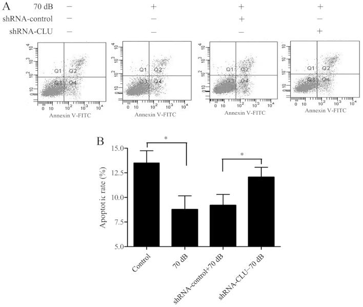 https://cdn.ncbi.nlm.nih.gov/pmc/blobs/37dc/4314421/a7f036e209ae/IJMM-35-03-0637-g05.jpg