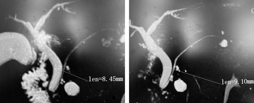 https://cdn.ncbi.nlm.nih.gov/pmc/blobs/37dc/9889197/fc938d25ecb7/sle-33-62-g002.jpg