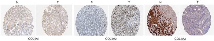 https://cdn.ncbi.nlm.nih.gov/pmc/blobs/37df/8799138/1a4a5577f9e3/tcr-09-09-5218-fS.2.jpg