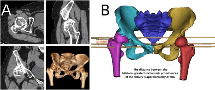 https://cdn.ncbi.nlm.nih.gov/pmc/blobs/37e2/12134230/17e9159d7299/41598_2025_4586_Fig2_HTML.jpg