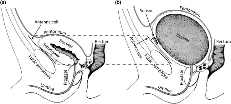 https://cdn.ncbi.nlm.nih.gov/pmc/blobs/37ea/5840221/131ca8ef2879/40846_2017_244_Fig1_HTML.jpg