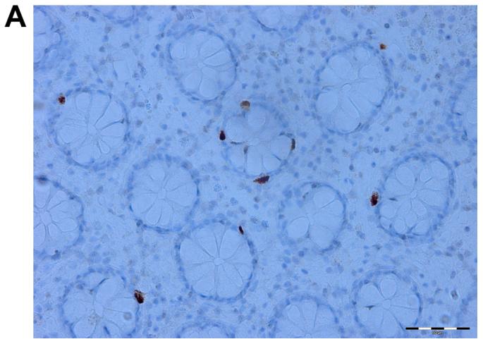 https://cdn.ncbi.nlm.nih.gov/pmc/blobs/37ed/5593462/e31b13ef2621/IJMM-40-04-0943-g02.jpg