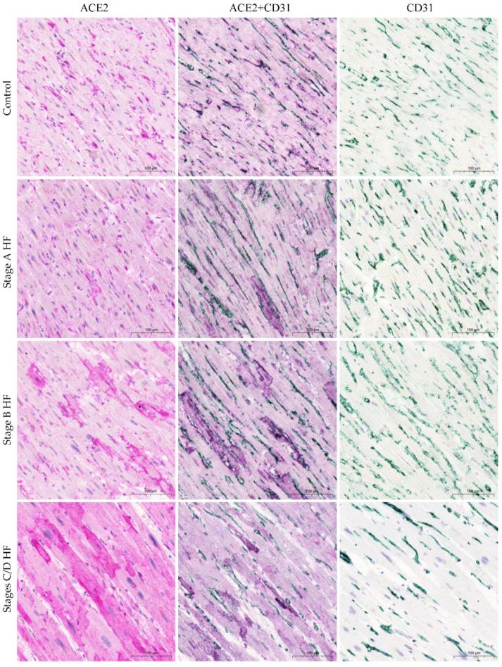 https://cdn.ncbi.nlm.nih.gov/pmc/blobs/37f6/10743033/10fc568a61c2/ijms-24-17145-g004.jpg