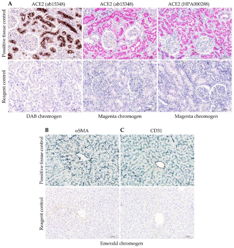 https://cdn.ncbi.nlm.nih.gov/pmc/blobs/37f6/10743033/3e931d0dbcaf/ijms-24-17145-g005.jpg