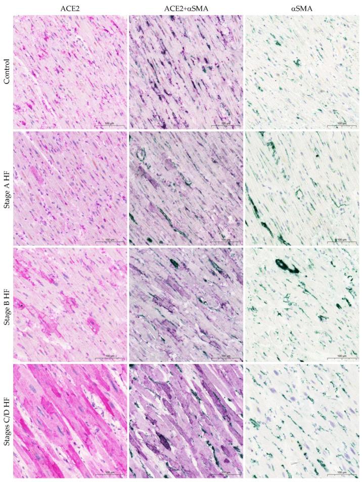 https://cdn.ncbi.nlm.nih.gov/pmc/blobs/37f6/10743033/b3a732d26237/ijms-24-17145-g003.jpg