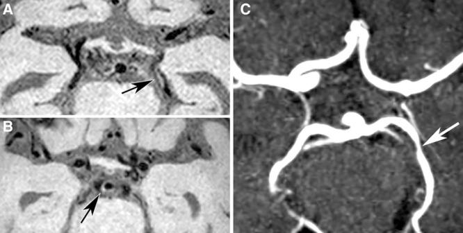 https://cdn.ncbi.nlm.nih.gov/pmc/blobs/37f8/4927221/6d4f972a9ea6/str-47-1797-g004.jpg