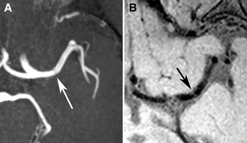 https://cdn.ncbi.nlm.nih.gov/pmc/blobs/37f8/4927221/e66f79dfcdf4/str-47-1797-g006.jpg