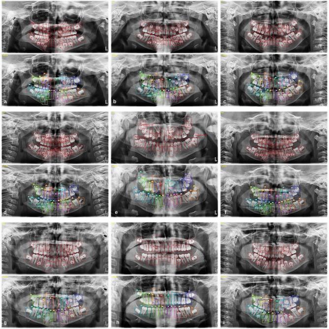 https://cdn.ncbi.nlm.nih.gov/pmc/blobs/3800/11238494/922023af1bd4/12880_2024_1338_Fig5_HTML.jpg