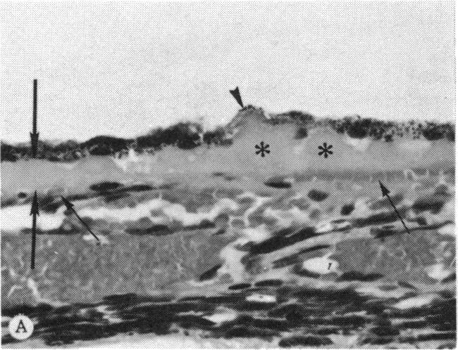 https://cdn.ncbi.nlm.nih.gov/pmc/blobs/3807/1311549/2cdec1c50afb/taos00024-0267-a.jpg