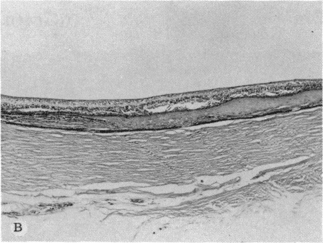 https://cdn.ncbi.nlm.nih.gov/pmc/blobs/3807/1311549/6b3eb0c500ab/taos00024-0264-b.jpg