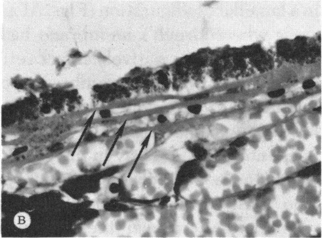 https://cdn.ncbi.nlm.nih.gov/pmc/blobs/3807/1311549/6b69239fd8d9/taos00024-0268-b.jpg
