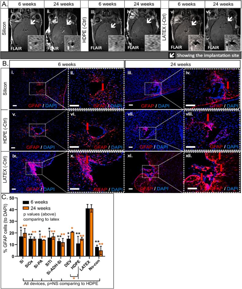 https://cdn.ncbi.nlm.nih.gov/pmc/blobs/3808/12088817/4274ff510092/gr5.jpg