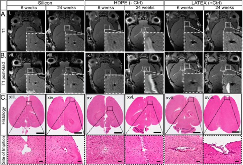 https://cdn.ncbi.nlm.nih.gov/pmc/blobs/3808/12088817/9a7ea85ecb20/gr4.jpg