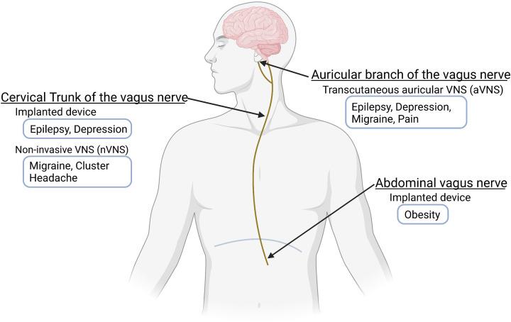 https://cdn.ncbi.nlm.nih.gov/pmc/blobs/380d/9093220/a7619dc419c7/cs-136-cs20210507-g1.jpg