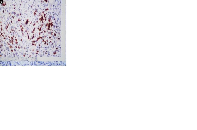 https://cdn.ncbi.nlm.nih.gov/pmc/blobs/3810/10645280/e358a8ca4055/tjg-34-10-1014_f001.jpg