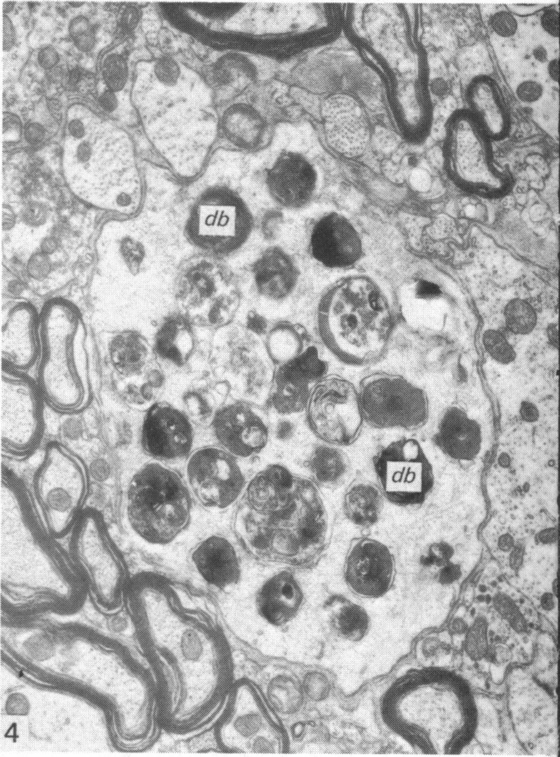 https://cdn.ncbi.nlm.nih.gov/pmc/blobs/3817/1167604/2cdcf5a71629/janat00223-0004-d.jpg