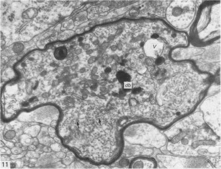 https://cdn.ncbi.nlm.nih.gov/pmc/blobs/3817/1167604/a9f433a0481f/janat00223-0009-a.jpg