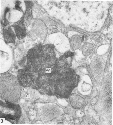 https://cdn.ncbi.nlm.nih.gov/pmc/blobs/3817/1167604/c5eb84d1bb7b/janat00223-0004-c.jpg