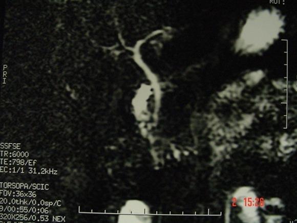 https://cdn.ncbi.nlm.nih.gov/pmc/blobs/381d/5837181/62106d31fb73/PAMJ-28-114-g004.jpg