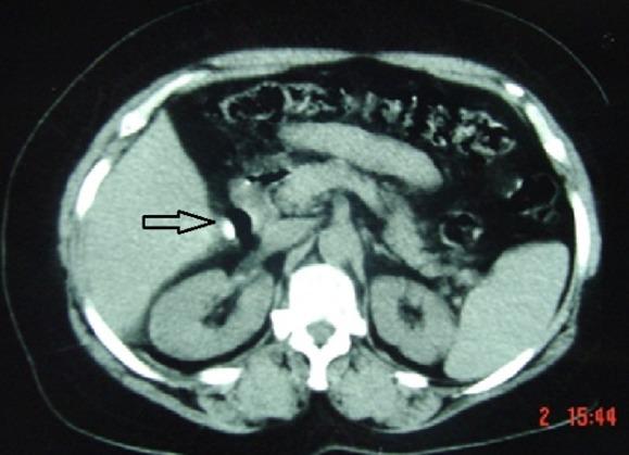 https://cdn.ncbi.nlm.nih.gov/pmc/blobs/381d/5837181/ad179bd6e6e5/PAMJ-28-114-g001.jpg