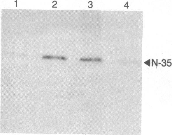 https://cdn.ncbi.nlm.nih.gov/pmc/blobs/381e/390494/1cf650e092bf/pnas00355-0187-a.jpg