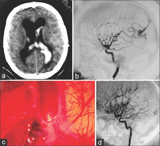 https://cdn.ncbi.nlm.nih.gov/pmc/blobs/3820/5339909/a36b46107cce/SNI-8-27-g004.jpg