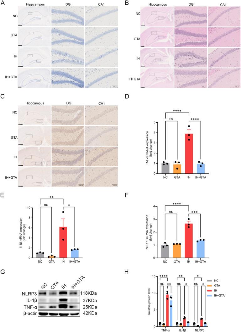 https://cdn.ncbi.nlm.nih.gov/pmc/blobs/3826/12067661/fcbad5a5e891/JIR-18-5931-g0009.jpg
