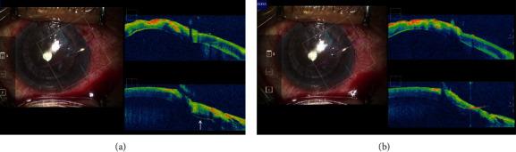 https://cdn.ncbi.nlm.nih.gov/pmc/blobs/3826/7803131/88c33ca58c80/joph2020-1497089.001.jpg