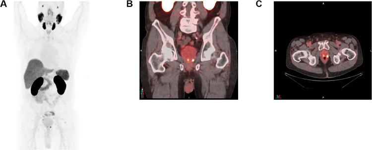 https://cdn.ncbi.nlm.nih.gov/pmc/blobs/382c/11298587/f6df07ddda07/gr3.jpg