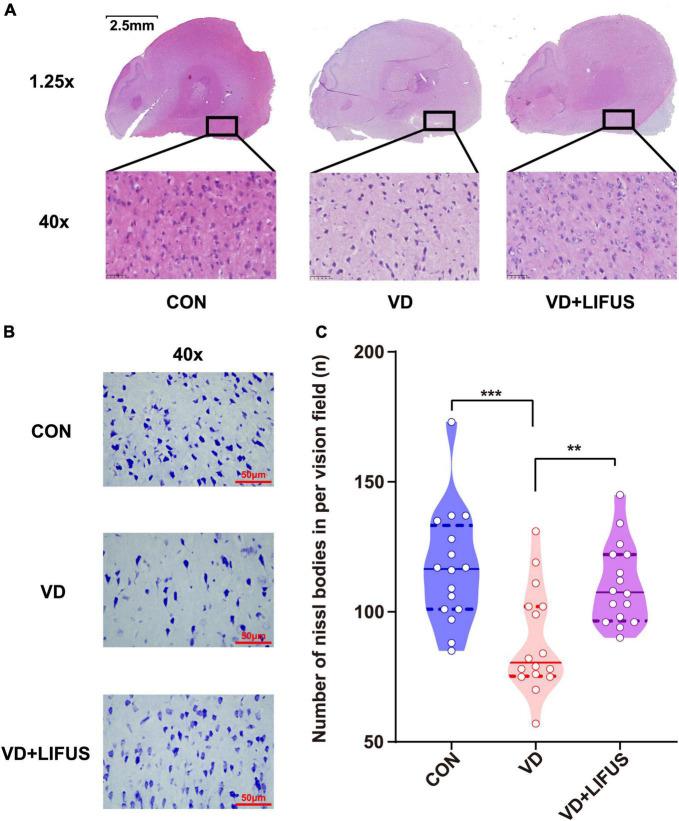 https://cdn.ncbi.nlm.nih.gov/pmc/blobs/382e/8899543/bb201fe1aa47/fnagi-14-814560-g004.jpg