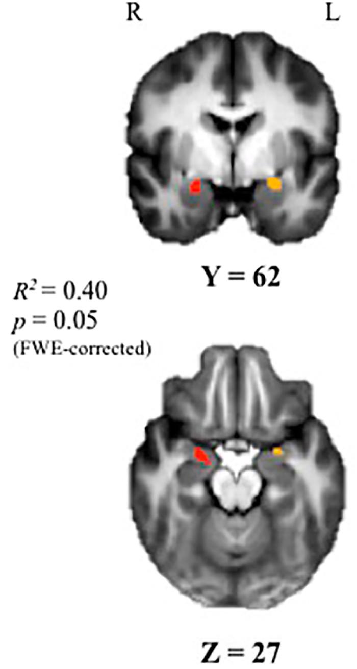 https://cdn.ncbi.nlm.nih.gov/pmc/blobs/382f/5181835/1d69d75d40b1/srep37081-f2.jpg