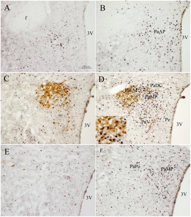 https://cdn.ncbi.nlm.nih.gov/pmc/blobs/3830/3157380/187f9dc4e431/pone.0023362.g003.jpg