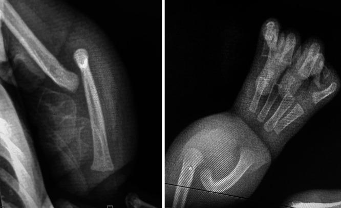 https://cdn.ncbi.nlm.nih.gov/pmc/blobs/383a/11058404/c78e07a23540/CASE24177f3.jpg