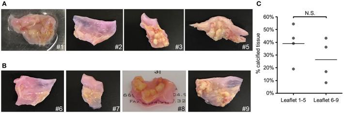 https://cdn.ncbi.nlm.nih.gov/pmc/blobs/383b/6476921/3e76a62b5140/fcvm-06-00049-g0002.jpg