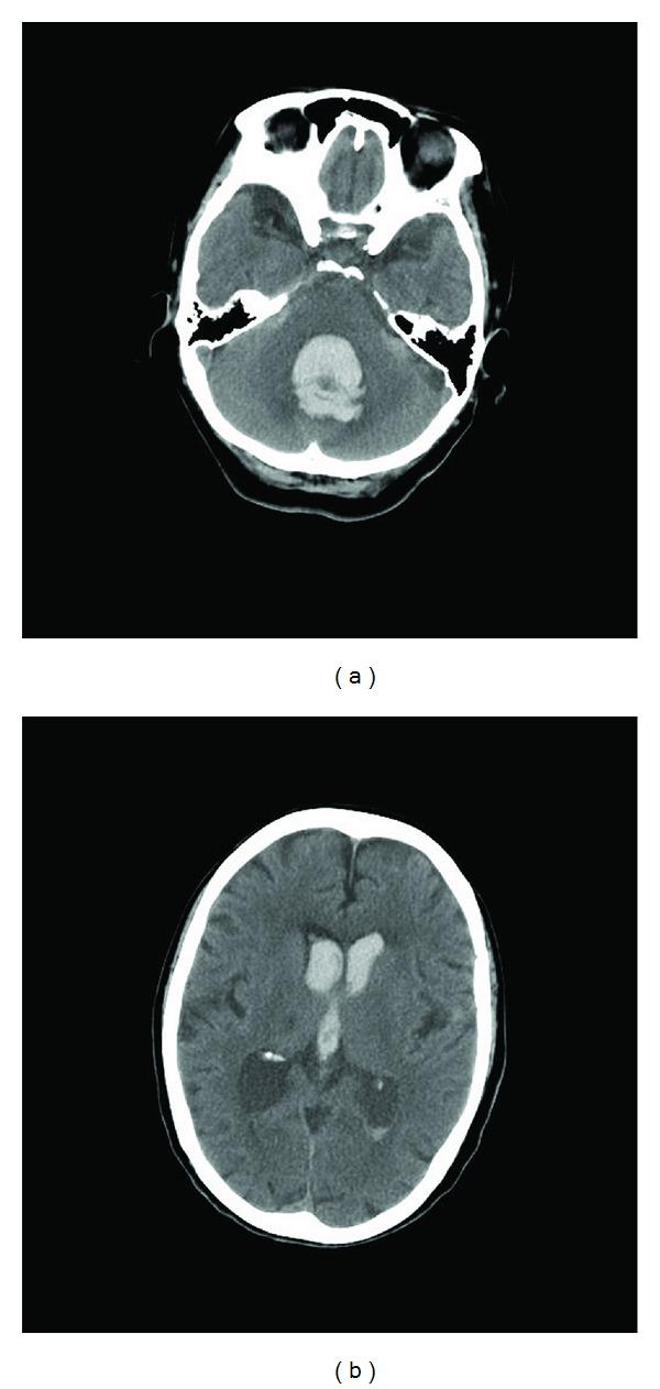 https://cdn.ncbi.nlm.nih.gov/pmc/blobs/383f/3420634/b75a91b0e031/CRIM.NM2012-306171.001.jpg
