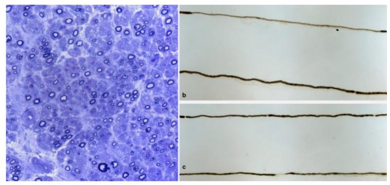 https://cdn.ncbi.nlm.nih.gov/pmc/blobs/383f/7692609/5286f5c01596/brainsci-10-00780-g003.jpg