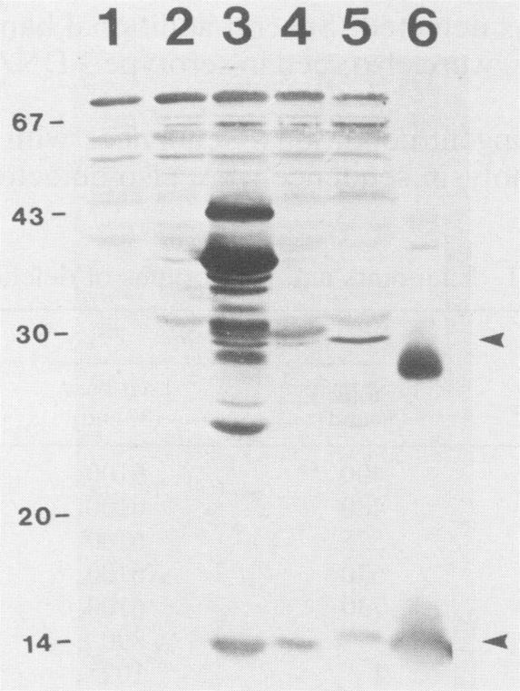 https://cdn.ncbi.nlm.nih.gov/pmc/blobs/3840/259828/1400e44eea61/iai00071-0132-c.jpg